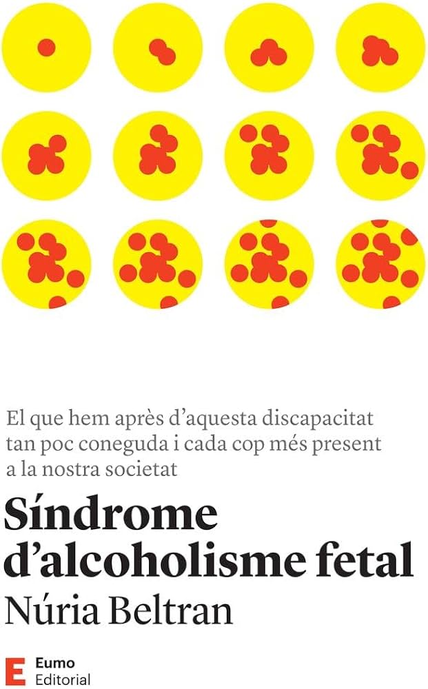 Síndrome d'alcoholisme fetal